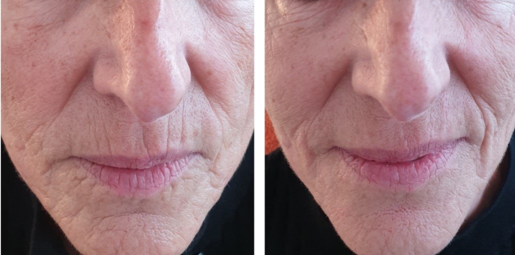 Viscoderm hydrobooster​-Aging Gesichtspflege – Cosmetic4you Kosmetikstudio in Walliselle
